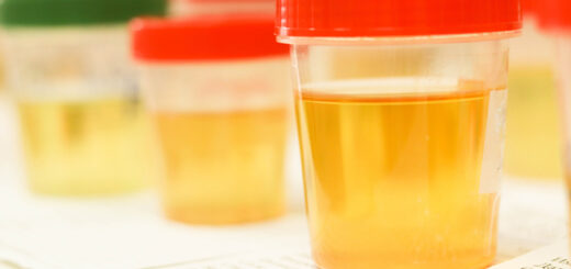 Kolor moczu i zapach a stan zdrowia. Test z kropli oleju sezamowego