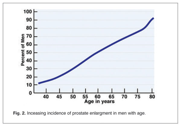 lagodny przerost prostaty statystyki