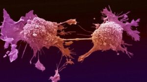 Chemioterapia rozprzestrzenia raka na cały organizm - kolejne wyniki badań
