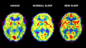 fazy snu mózg